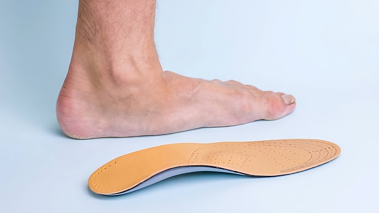 flat feet with insoles